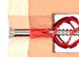 Пластиковые дюбеля для крепления - тип 2