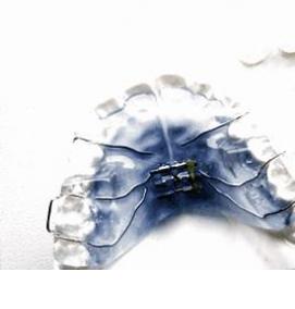 твинблок рефтинский - модель 4