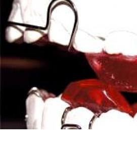 твинблок рефтинский - модель 2