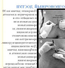 ультразвуковая визуализация - вариант 1