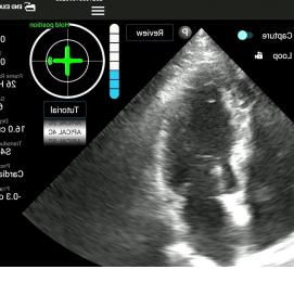 ультразвуковая визуализация - вариант 4