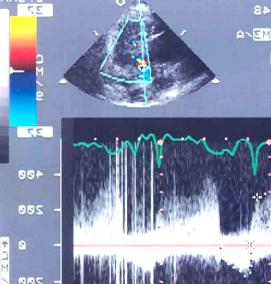 ультразвуковая визуализация - вариант 3