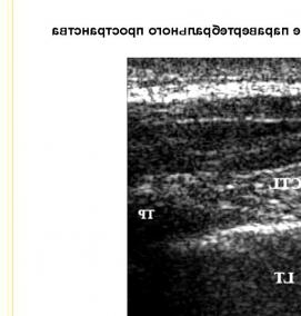 Визуализация позвоночника - вариант 4