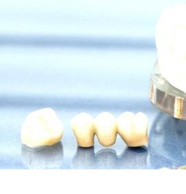 Восстановление коронок - тип 1