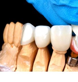 Восстановление коронок - тип 3